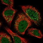 Immunofluorescent staining of human cell line A549 shows localization to nucleoplasm & vesicles.