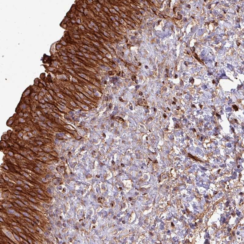 Anti-ZNF300 Antibody
