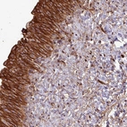 Anti-ZNF300 Antibody