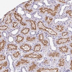 Anti-RADIL Antibody