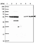 Lane 1: Marker [kDa] 250, 130, 95, 72, 55, 36, 28, 17, 10_br/_Lane 2: Human cell line RT-4_br/_Lane 3: Human cell line U-251MG sp_br/_Lane 4: Human plasma (IgG/HSA depleted)_br/_Lane 5: Human liver tissue_br/_Lane 6: Human tonsil tissue