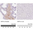 Anti-SMTN Antibody