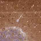 Immunohistochemical staining of human cerebellum shows strong cytoplasmic positivity in purkinje cells and cells in molecular layer.