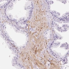 Immunohistochemical staining of human prostate shows moderate cytoplasmic positivity in smooth muscle cells.