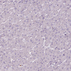 Anti-CAMK2A Antibody