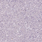 Immunohistochemical staining of human Liver shows no positivity in hepatocytes as expected.