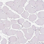 Immunohistochemical staining of human skeletal muscle shows no positivity in myocytes as expected.