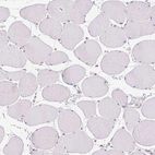 Immunohistochemical staining of human skeletal muscle shows no positivity in myocytes as expected.