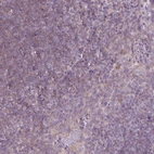 Immunohistochemical staining of human Tonsil shows no positivity in non-germinal center cells as expected.