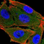 Immunofluorescent staining of human cell line PC-3 shows localization to plasma membrane & cytosol.