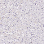 Immunohistochemical staining of human liver shows no positivity in hepatocytes as expected.