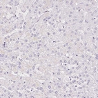 Immunohistochemical staining of human liver shows no positivity in hepatocytes as expected.