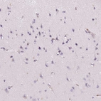 Immunohistochemical staining of human cerebral cortex shows no positivity in neurons as expected.