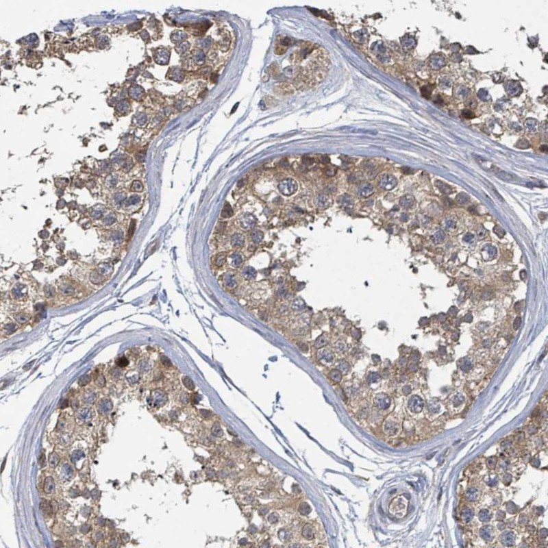 Anti-CCDC121 Antibody