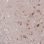 Anti-CAMK2A Antibody