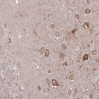 Anti-CAMK2A Antibody