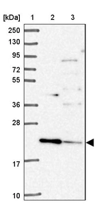 Lane 1: Marker [kDa] 250, 130, 95, 72, 55, 36, 28, 17, 10_br/_Lane 2: Human cell line RT-4_br/_Lane 3: Human cell line U-251MG sp