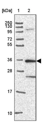Lane 1: Marker [kDa] 250, 130, 95, 72, 55, 36, 28, 17, 10_br/_Lane 2: Human cell line RT-4