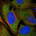 Immunofluorescent staining of human cell line U-2 OS shows localization to cytosol & actin filaments.