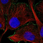 Immunofluorescent staining of human cell line U-2 OS shows localization to plasma membrane.