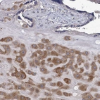 Anti-FKBP1A Antibody