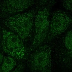 Immunofluorescent staining of human cell line MCF7 shows localization to nucleoplasm & cytosol.