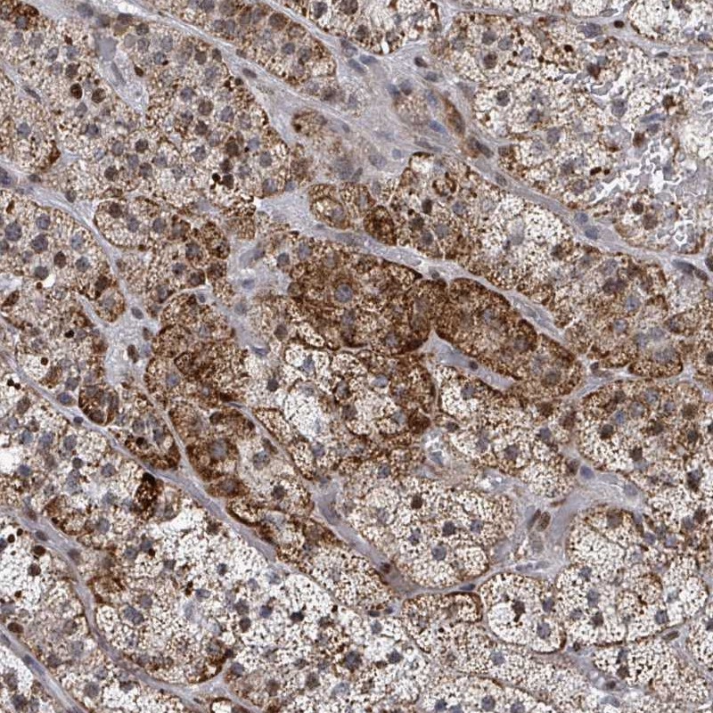 Anti-FNDC4 Antibody