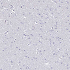 Immunohistochemical staining of human cerebral cortex shows no positivity in neurons as expected.