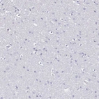Immunohistochemical staining of human cerebral cortex shows no positivity in neurons as expected.