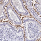 Immunohistochemical staining of human duodenum shows strong membranous positivity in glandular cells.