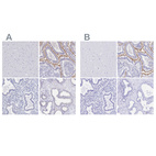 Immunohistochemical staining of human cerebral cortex, duodenum, endometrium and prostate using Anti-SLC5A1 antibody HPA051805 (A) shows similar protein distribution across tissues to independent antibody HPA055106 (B).
