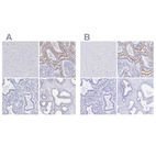 Immunohistochemical staining of human cerebral cortex, duodenum, endometrium and prostate using Anti-SLC5A1 antibody HPA051805 (A) shows similar protein distribution across tissues to independent antibody HPA055106 (B).