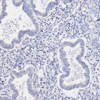 Immunohistochemical staining of human endometrium shows no positivity in glandular cells as expected.