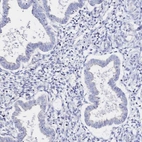 Immunohistochemical staining of human endometrium shows no positivity in glandular cells as expected.