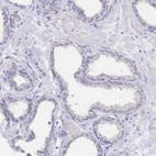 Immunohistochemical staining of human prostate shows no positivity in glandular cells as expected.