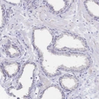 Immunohistochemical staining of human prostate shows no positivity in glandular cells as expected.