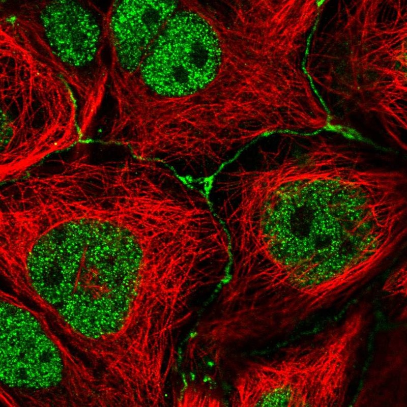 Anti-IGSF23 Antibody