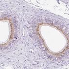 Anti-GOLGA8A Antibody
