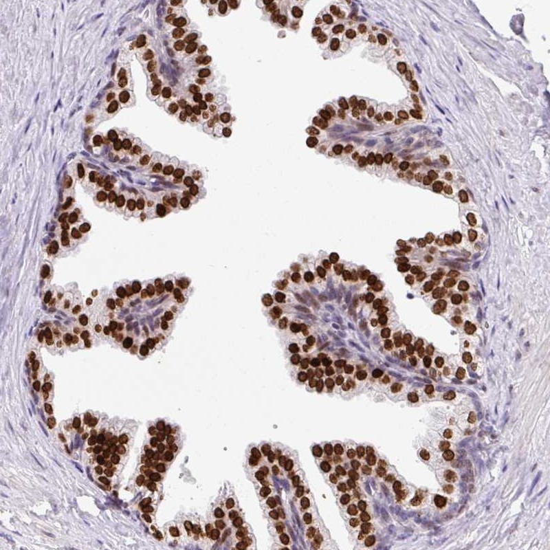 Anti-C2orf71 Antibody