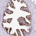 Anti-C2orf71 Antibody