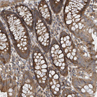 Immunohistochemical staining of human colon shows strong cytoplasmic positivity in glandular cells.