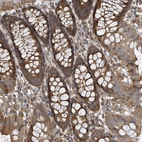 Immunohistochemical staining of human colon shows strong cytoplasmic positivity in glandular cells.