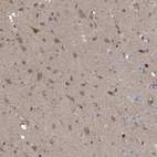 Immunohistochemical staining of human cerebral cortex shows weak cytoplasmic positivity in neurons.