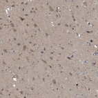 Immunohistochemical staining of human cerebral cortex shows weak cytoplasmic positivity in neurons.