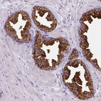 Immunohistochemical staining of human prostate shows strong cytoplasmic positivity in glandular cells.