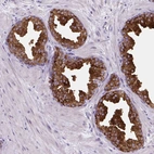 Immunohistochemical staining of human prostate shows strong cytoplasmic positivity in glandular cells.