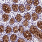 Immunohistochemical staining of human colon shows strong cytoplasmic positivity in glandular cells.