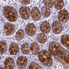 Immunohistochemical staining of human colon shows strong cytoplasmic positivity in glandular cells.