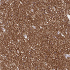 Immunohistochemical staining of human cerebral cortex shows moderate cytoplasmic positivity in neuropil.