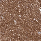 Immunohistochemical staining of human cerebral cortex shows moderate cytoplasmic positivity in neuropil.